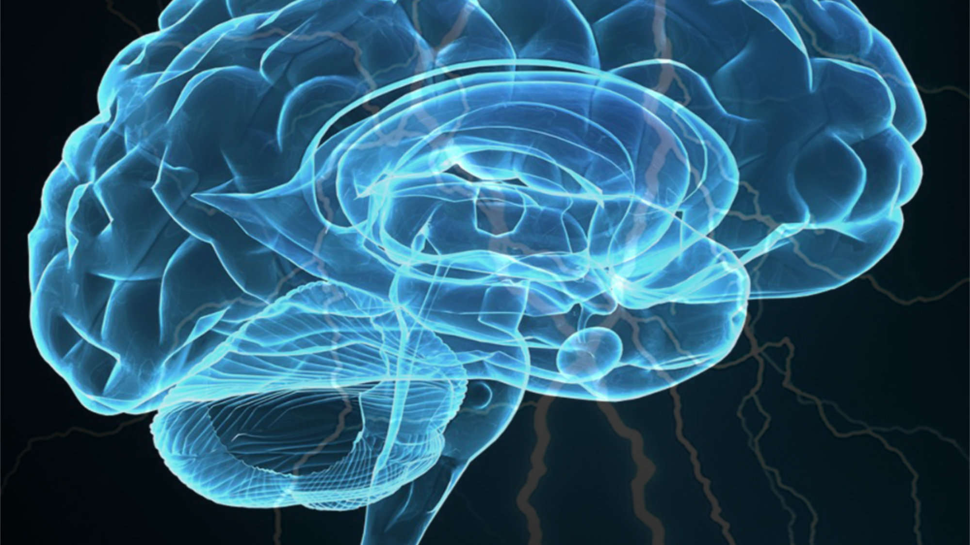 The x-ray of a brain